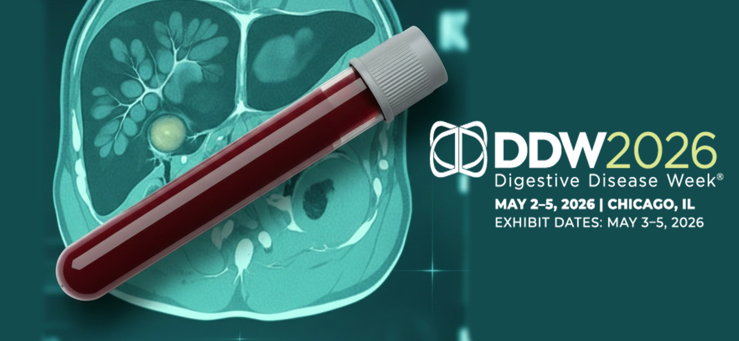 FIB News img- DDW2026